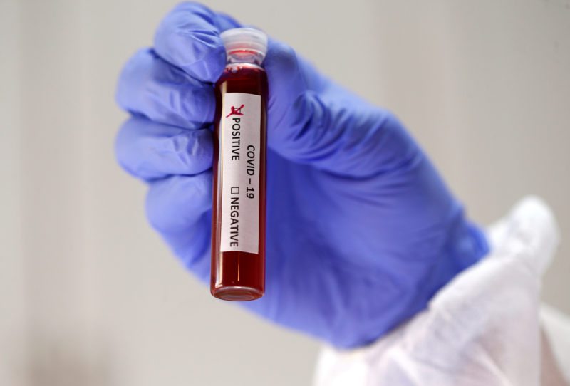 Coronavirus Update- उत्तराखंड में कोरोना को लेकर आज का हेल्थ बुलेटिन जारी, पढ़ें रिपोर्ट ..