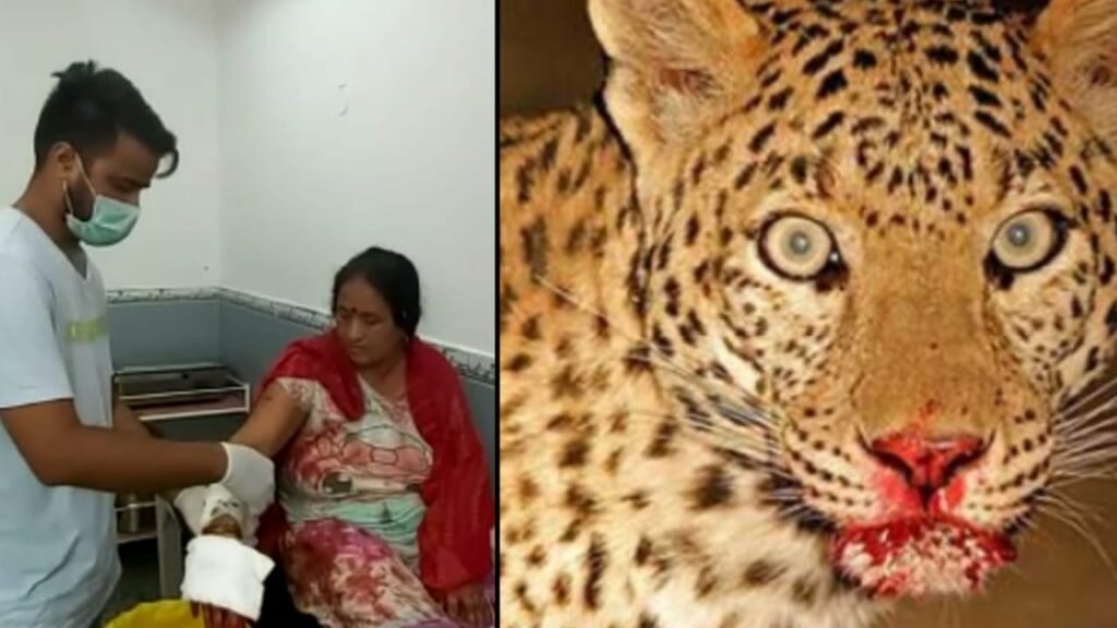 LEOPARD ATTACK IN WOMAN