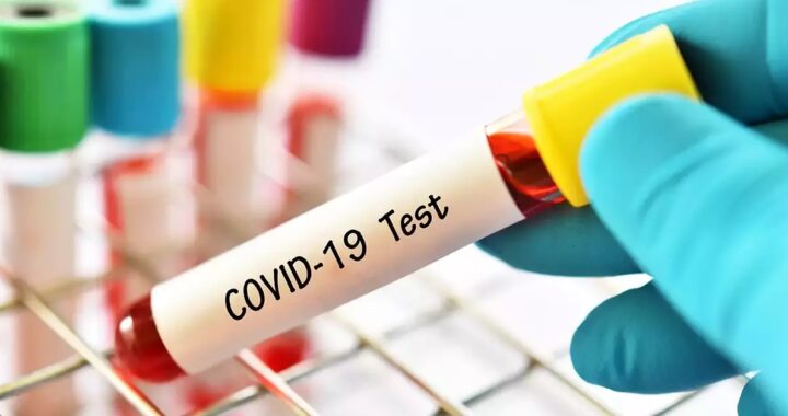 देहरादून-(बड़ी खबर) प्राइवेट लैब में RT- PCR जांच के सरकार ने रेट किए तय, अब इतने रुपए में होगा कोरोना का टेस्ट
