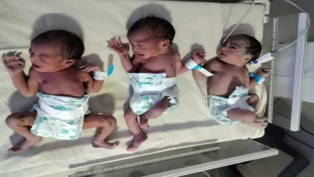 triplets baby born