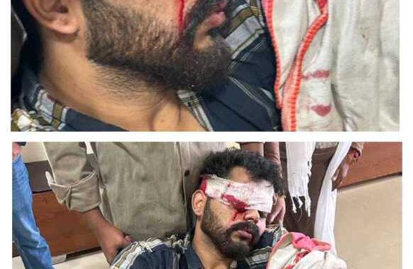 उत्तराखंड: आतिशबाजी ऐसे होती है जानलेवा साबित, यहां हुई घटना