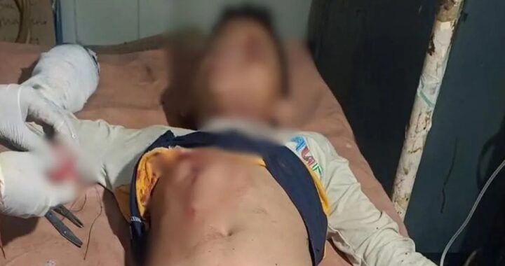 उत्तराखंड: यहाँ बारूद से भरी बोतल फटने से तीन किशोर झु़लसे