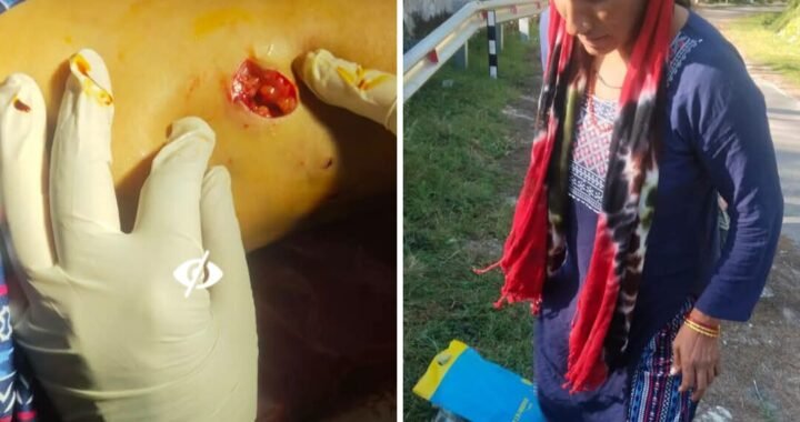 उत्तराखंड: यहां घर में घुसकर खूंखार बंदर ने पूर्व प्रधान पर किया जानलेवा हमला, कई टांके लगे